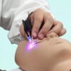 Csipeszes UV/LED Lámpa