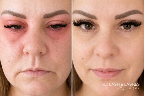 Érzékeny szemhéj ápolás műszempilla után - Eeesterlash Eye Care szérum